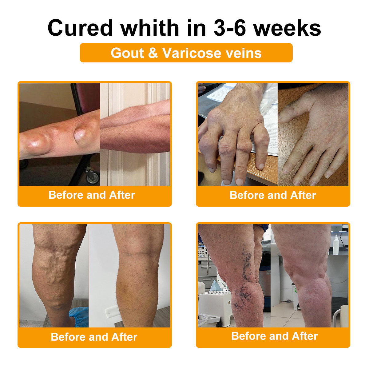DR.HONOR® All-In-One Joint & Bone Recovery Cream 🇺🇸(Specially for older adults)