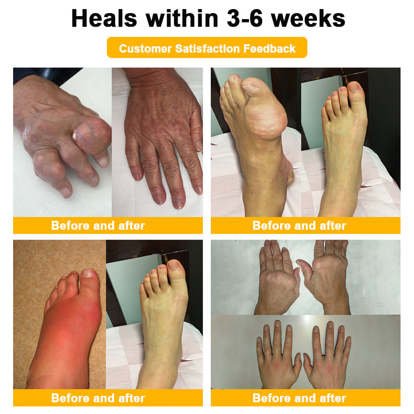 DR.HONOR® All-In-One Joint & Bone Recovery Cream 🇺🇸(Specially for older adults)