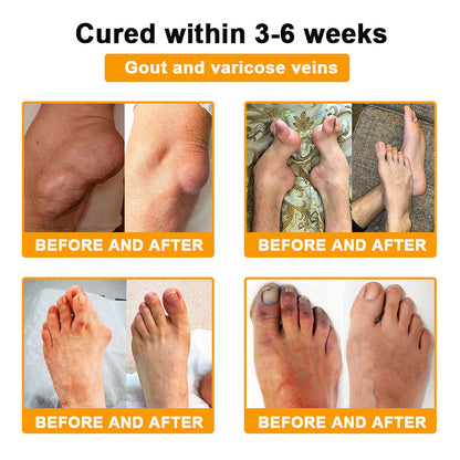 DR.HONOR® All-In-One Joint & Bone Recovery Cream 🇺🇸(Specially for older adults)