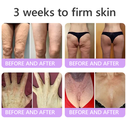 FDA Official: HISKIN® PDRN Multi-Peptide Massaging Body Roller Cream- Anti-aging, Hydrating, Skin Firming & Lifting, Skin Repair, Even Tone, Acne and Dark Spot Treatment, Wart and Mole Removal, and Psoriasis Relief.