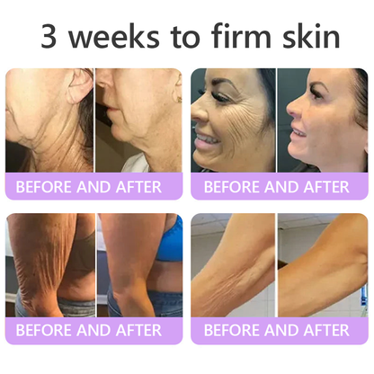 FDA Official: HISKIN® PDRN Multi-Peptide Massaging Body Roller Cream- Anti-aging, Hydrating, Skin Firming & Lifting, Skin Repair, Even Tone, Acne and Dark Spot Treatment, Wart and Mole Removal, and Psoriasis Relief.
